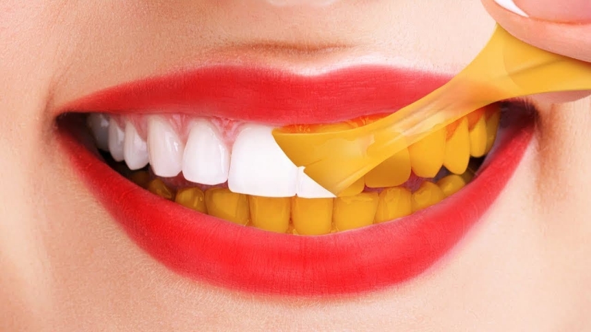 🦷 چه غذایی باعث زرد شدن دندان‌ها می‌شود؟
