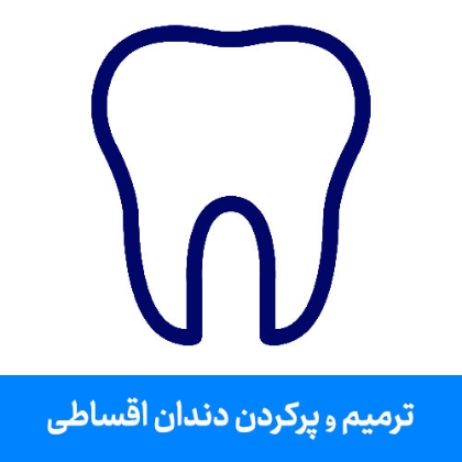 تصویر برای دسته  ترمیم و پر کردن دندان اقساطی