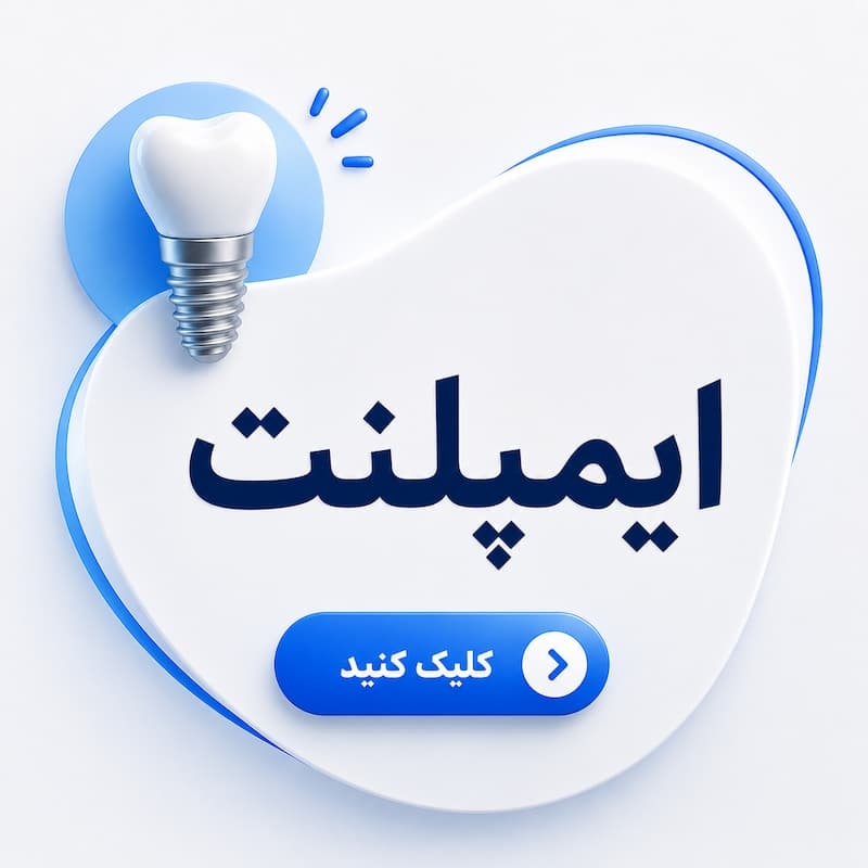 ایمپلنت اقساطی