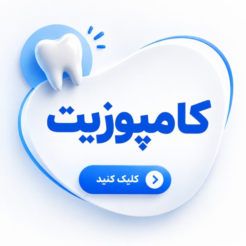 کامپوزیت اقساطی